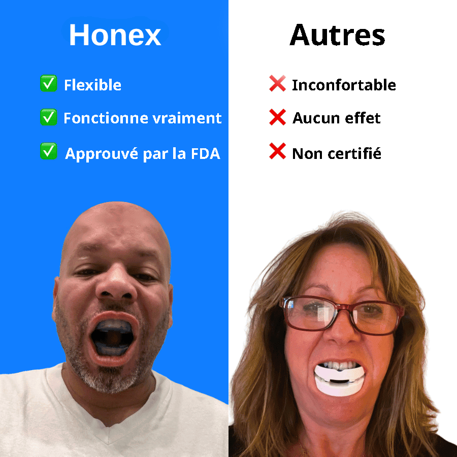 L’embout buccal anti-ronflement silencieux – Taille universelle